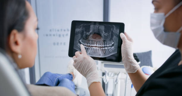 Licensed Tooth Extraction service in Aliso Viejo, CA - Smile Center Dentistry